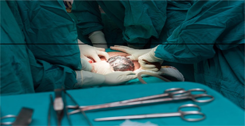 Pros and Cons of C-Section to the Baby