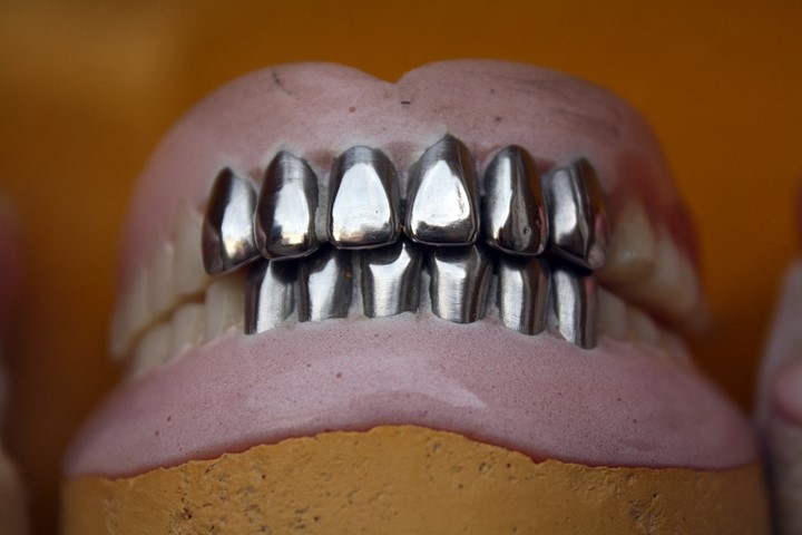 Pros and cons of dentures