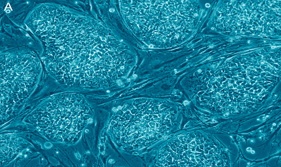 Pros and Cons of embryonic stem cells