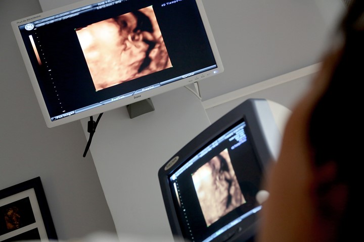 Pros and Cons of Being a Sonographer